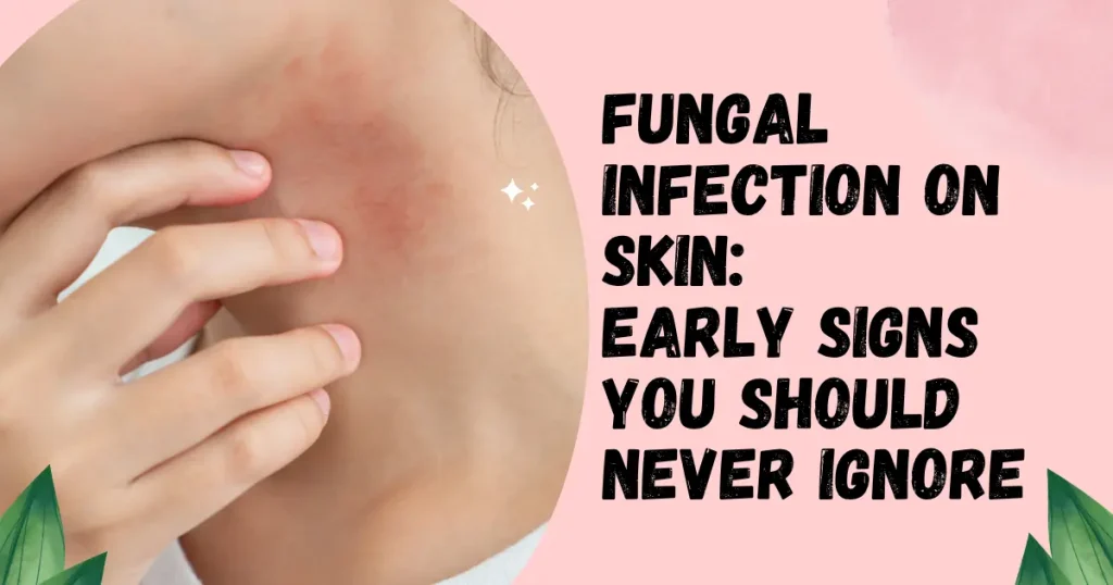 Fungal Infection Treatment in Rewari